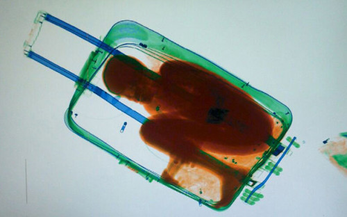 a x-ray of a person in a suitcase
